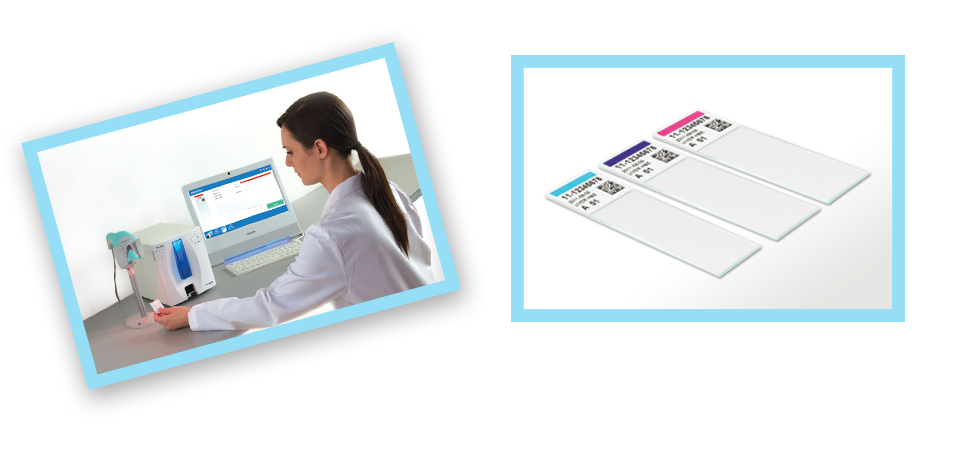 派美雅載玻片打號(hào)機(jī)工作現(xiàn)場(chǎng)